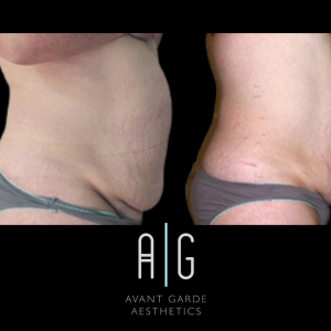 Untitled Design 11.png