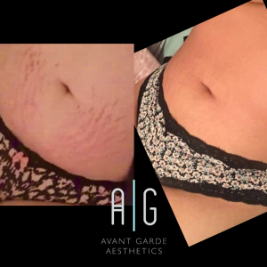 Untitled Design 14.png