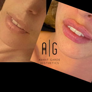 Untitled Design 3.png