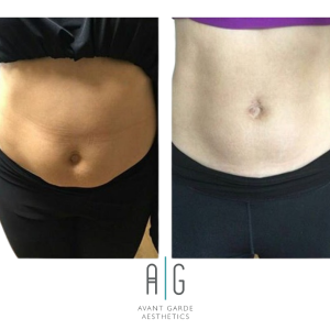 Untitled Design 8.png